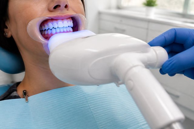 Luce una sonrisa más blanca con blanqueamiento dental en A Coruña - Imagen 1